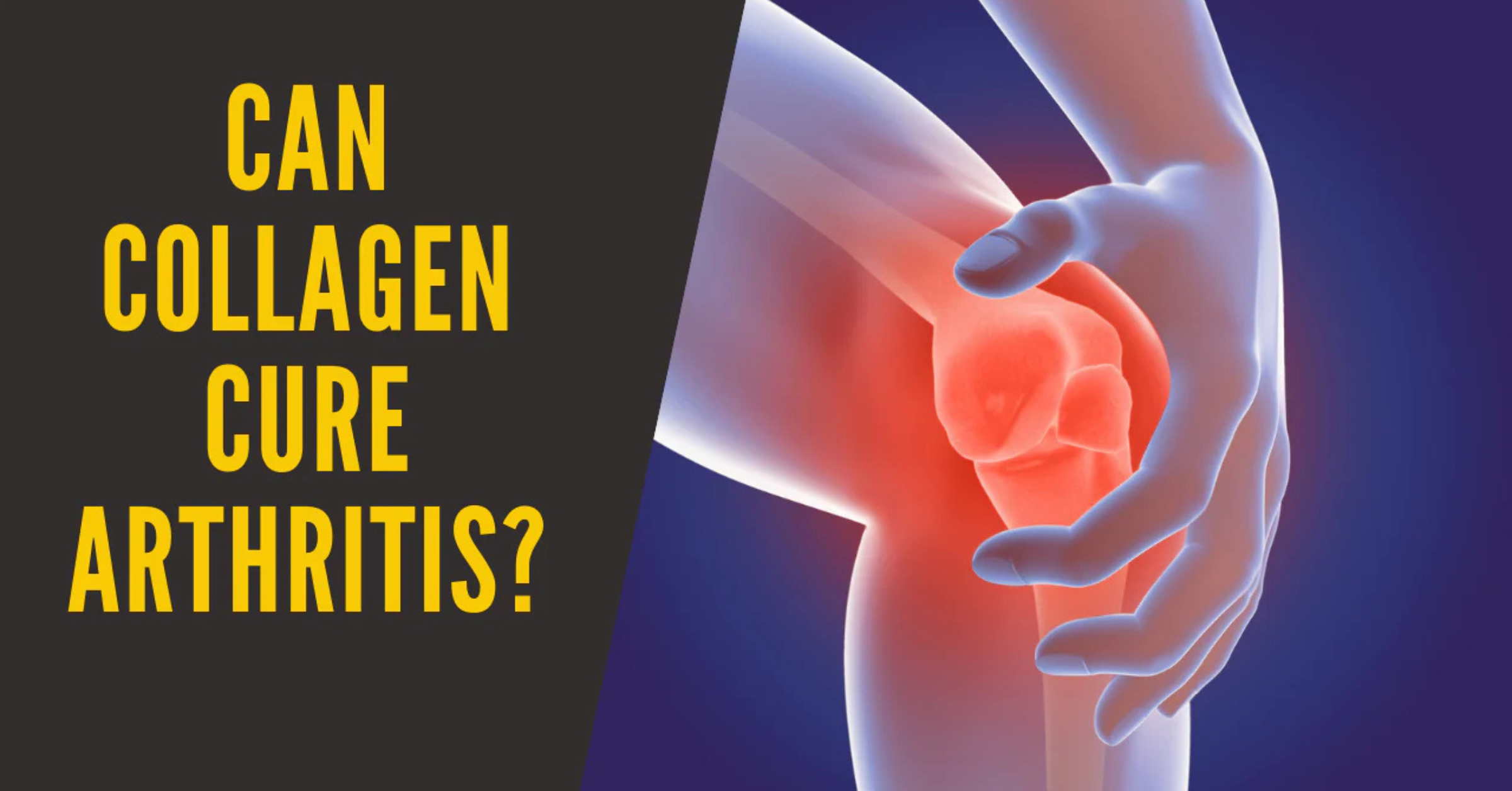 Can Collagen Cure Arthritis?